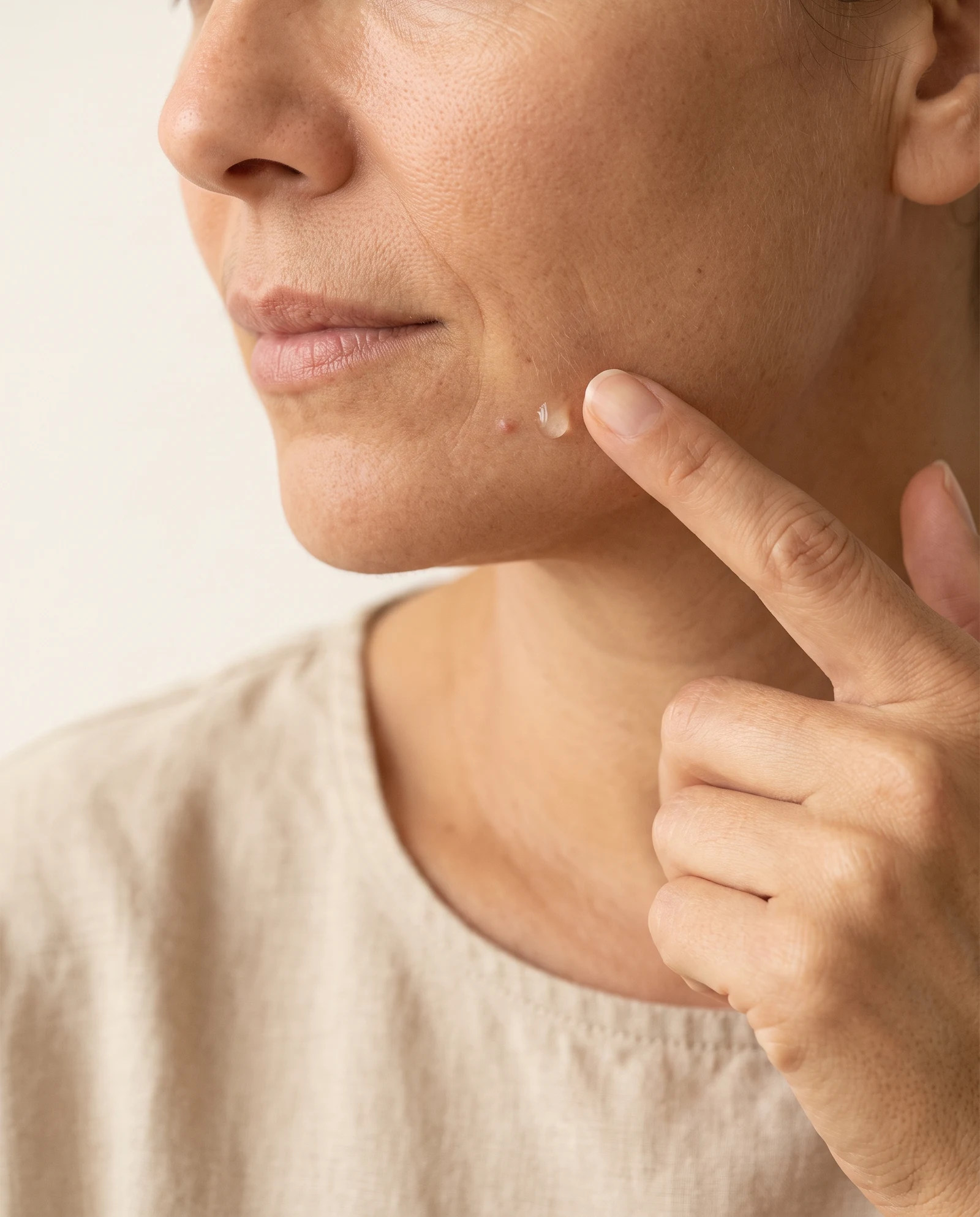 Aplicación de Gel Anti-imperfecciones
